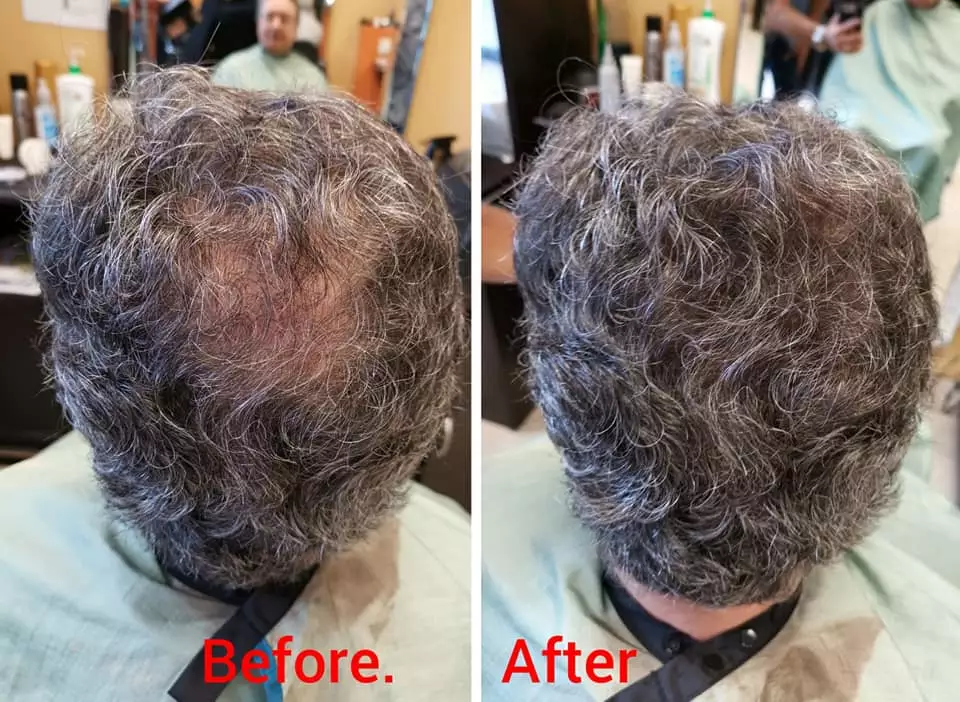 xLetayacoveringupbaldness.jpeg.pagespeed.ic.WXmgtvcCF7